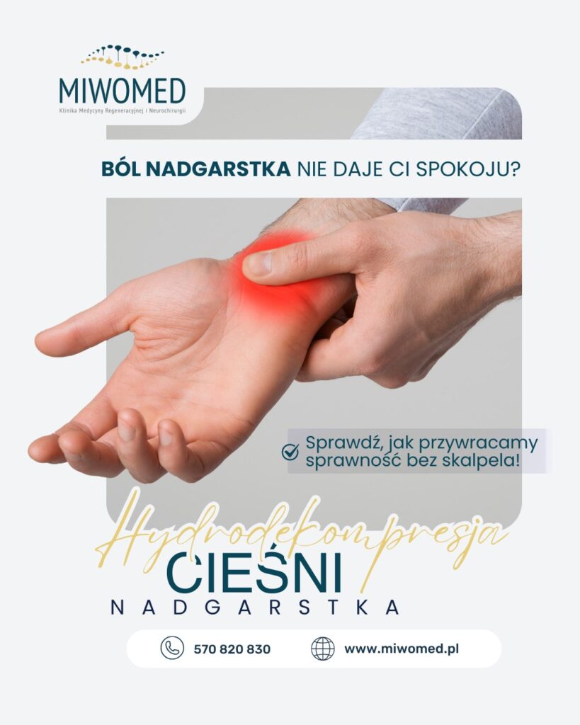 Cieśń nadgarstka - objawy, przyczyny i nowoczesne leczenie bez operacji (Gdańsk)